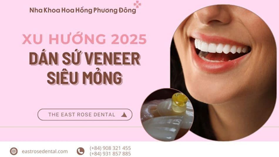 Dán Sứ Veneer - Xu Hướng Hot 2025 Cho Nụ Cười Hoàn Hảo