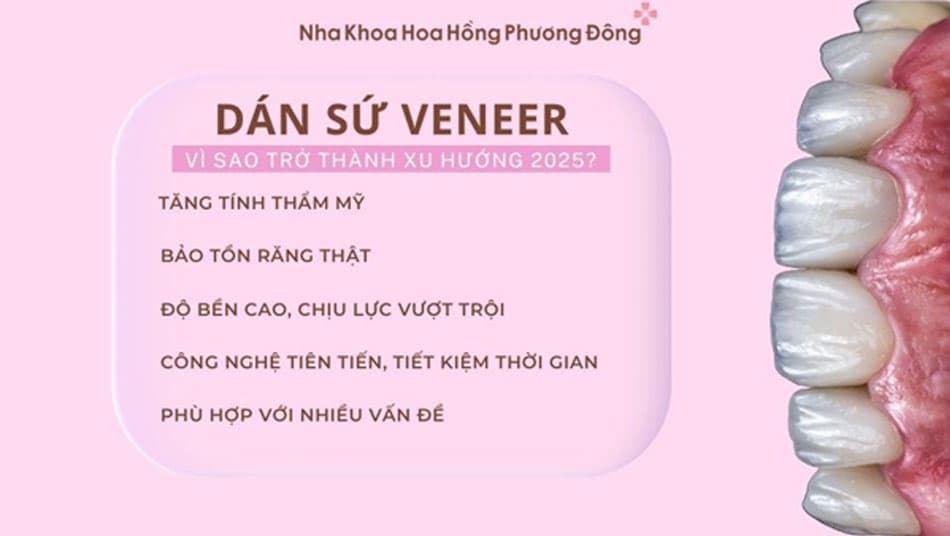 Dán sứ Veneer mang lại nhiều lợi ích vượt trội