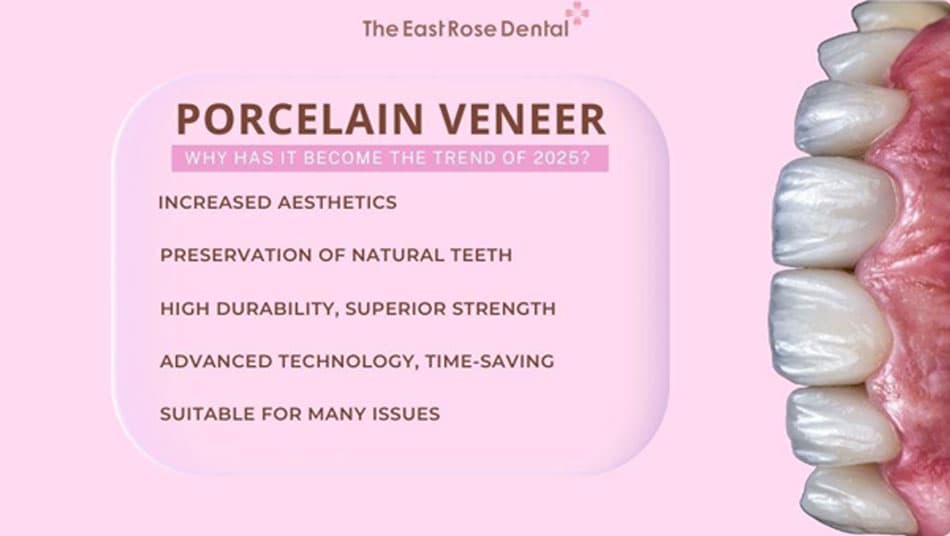 Veneer porcelain offers outstanding benefits