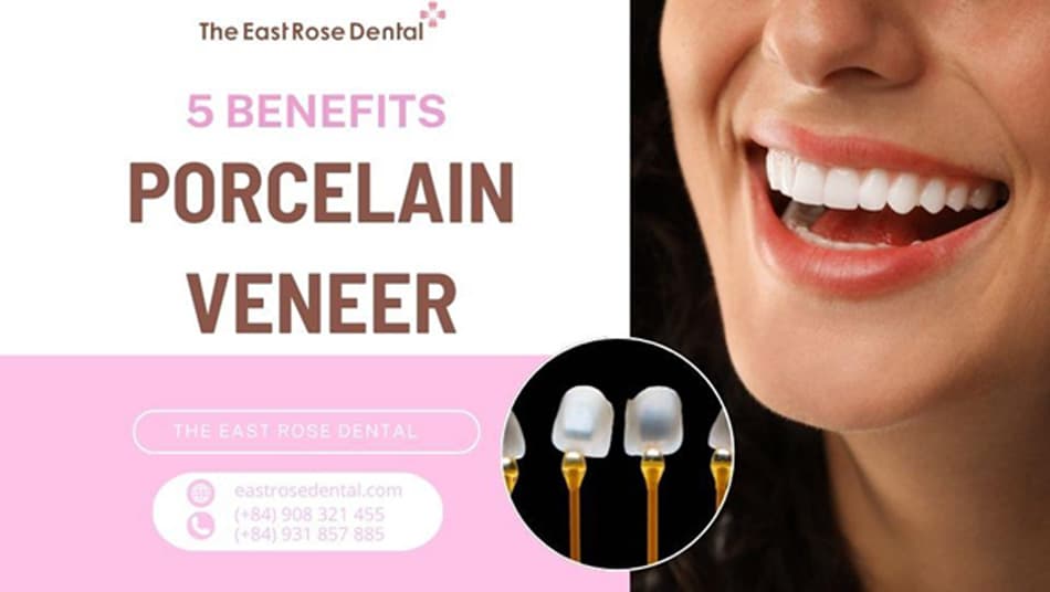 5 Outstanding Benefits of Ultra-Thin Porcelain Veneer