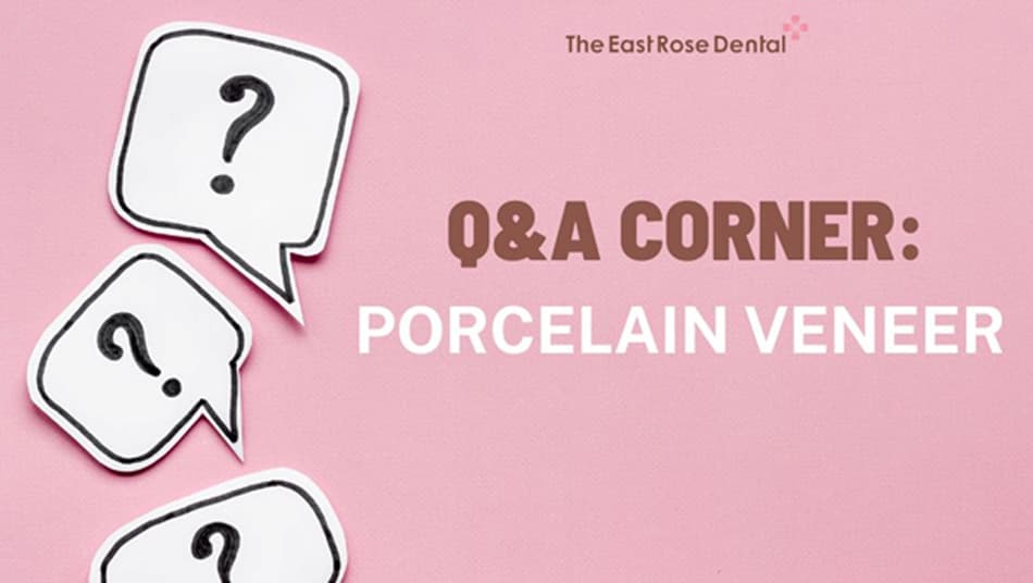 Answering Questions About Porcelain Veneers