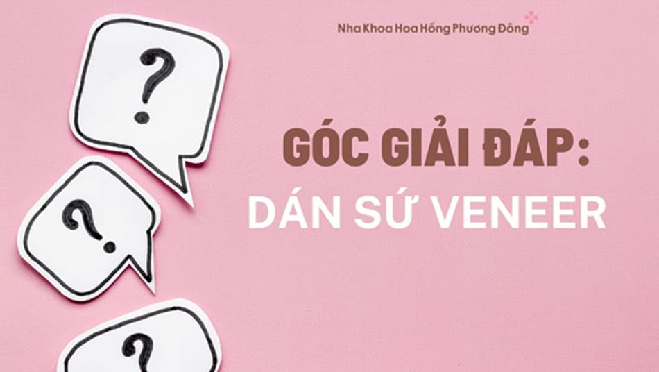 Giải đáp những câu hỏi liên quan đến dán sứ Veneer