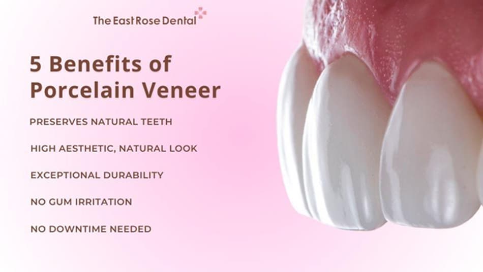 Porcelain Veneers Offer Many Outstanding Benefits