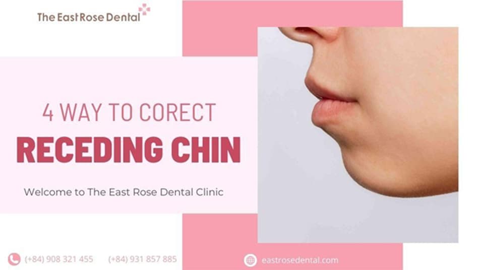 Is surgery needed for a receding chin? Effective solutions