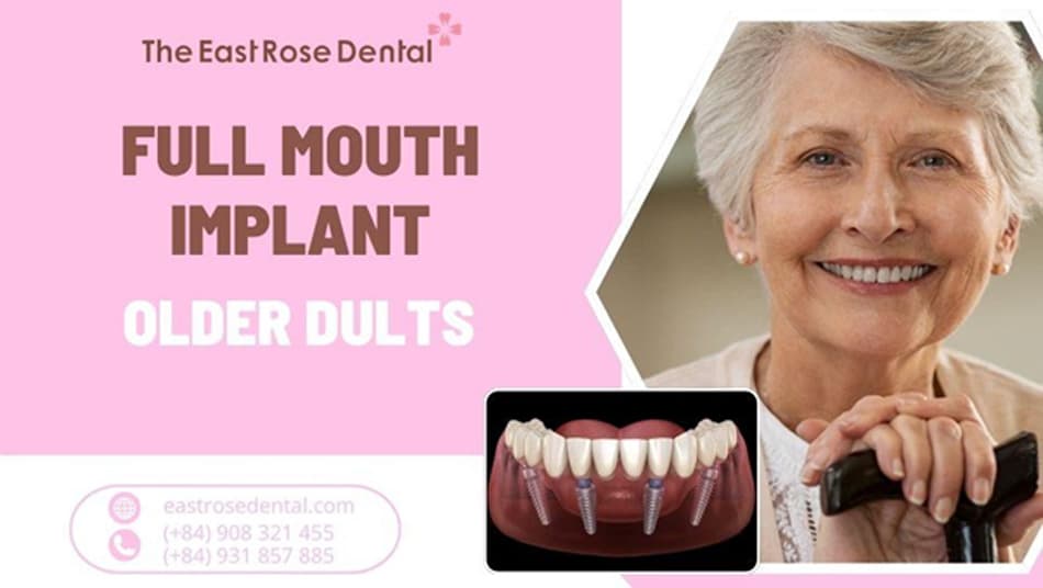 Can full-mouth dental implants be placed for the elderly?