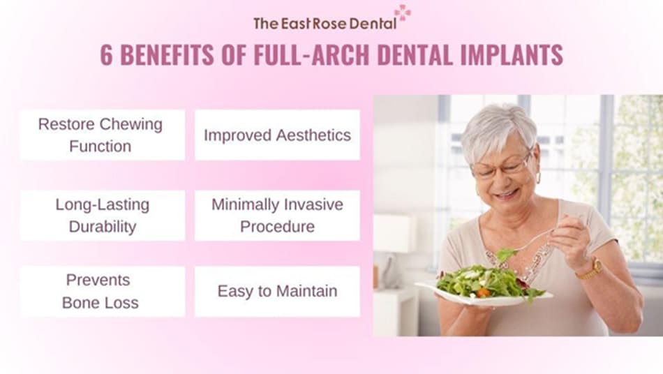 Full-mouth dental implants offer many benefits for the elderly