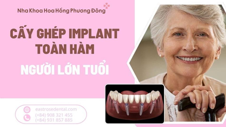 Trồng răng Implant toàn hàm cho người lớn tuổi có được không?