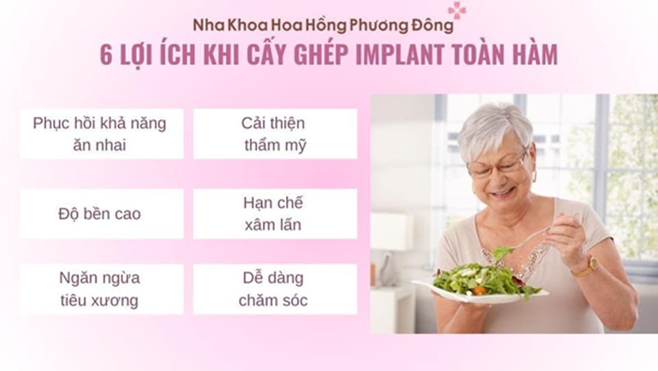 Trồng răng Implant toàn hàm mang đến nhiều lợi ích cho người lớn tuổi