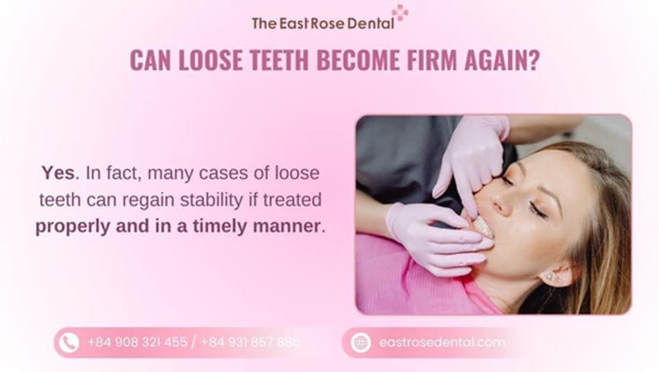 Loose teeth should be properly and promptly treated