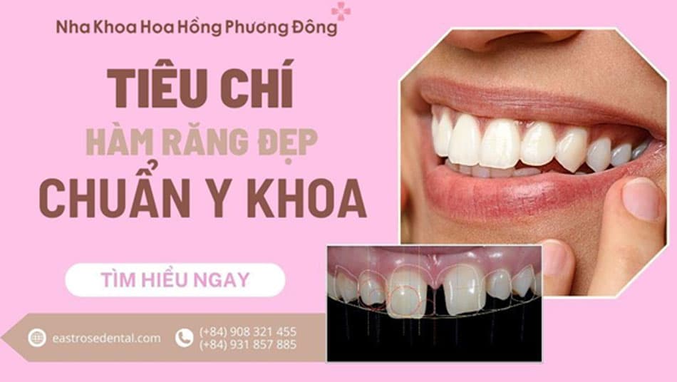 Hàm răng đẹp chuẩn Y khoa cần những yếu tố gì?