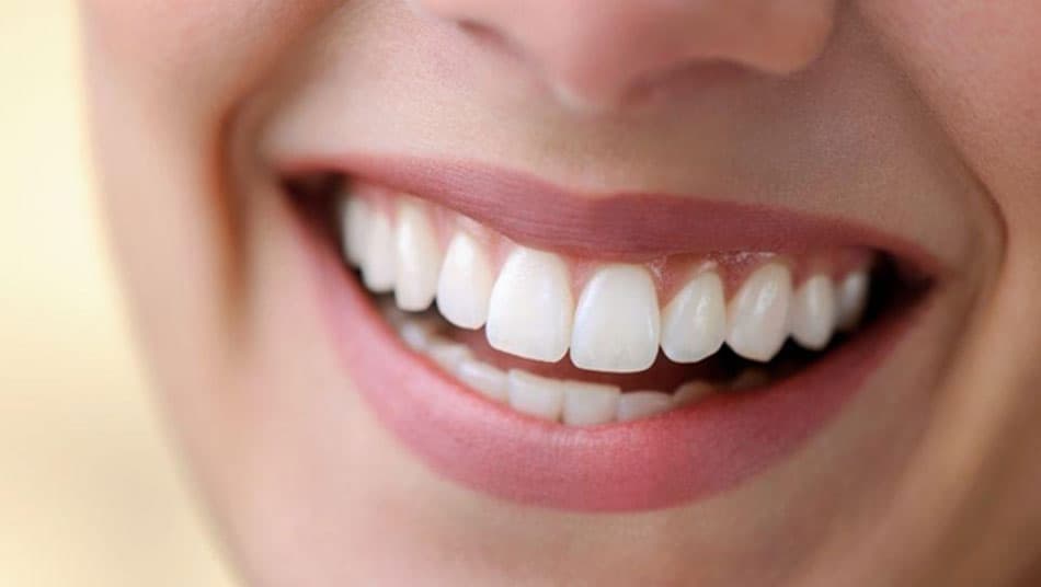 Tỷ lệ cân đối giữa răng và nướu là yếu tố quan trọng khi đánh giá hàm răng đẹp