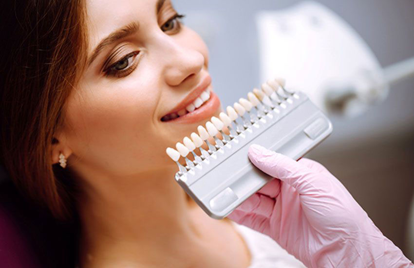 10 thousand questions on the topic of porcelain veneer