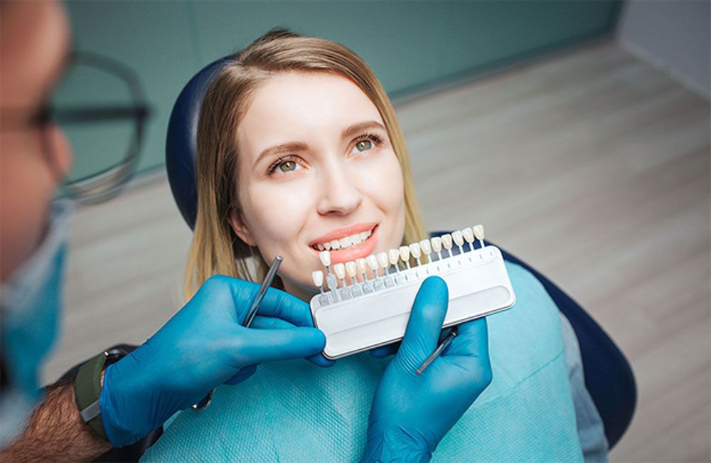 Top of the most popular porcelain veneer line currently