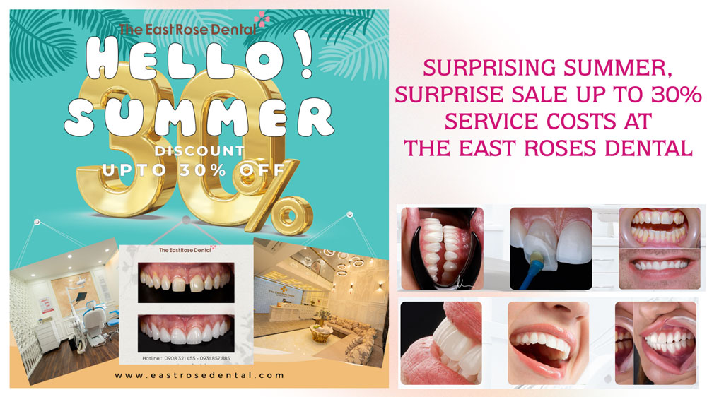 Special offer up to 30% off Porcelain Veneer at Rose Dental Clinic HCMC