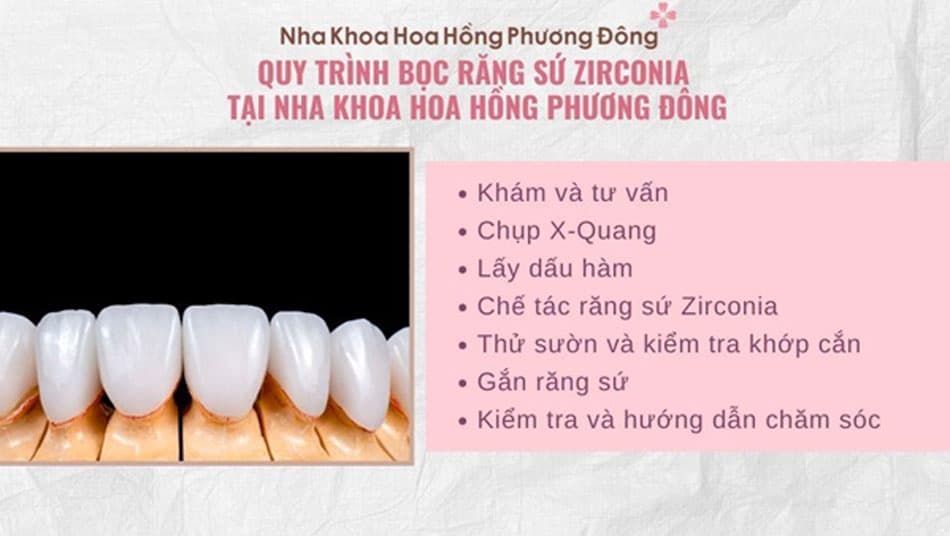 Quy trình bọc răng sứ Zirconia tại Nha Khoa Hoa Hồng Phương Đông
