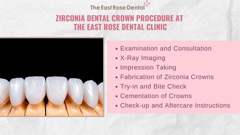 Zirconia full ceramic crown procedure at The East Rose Dental Clinic