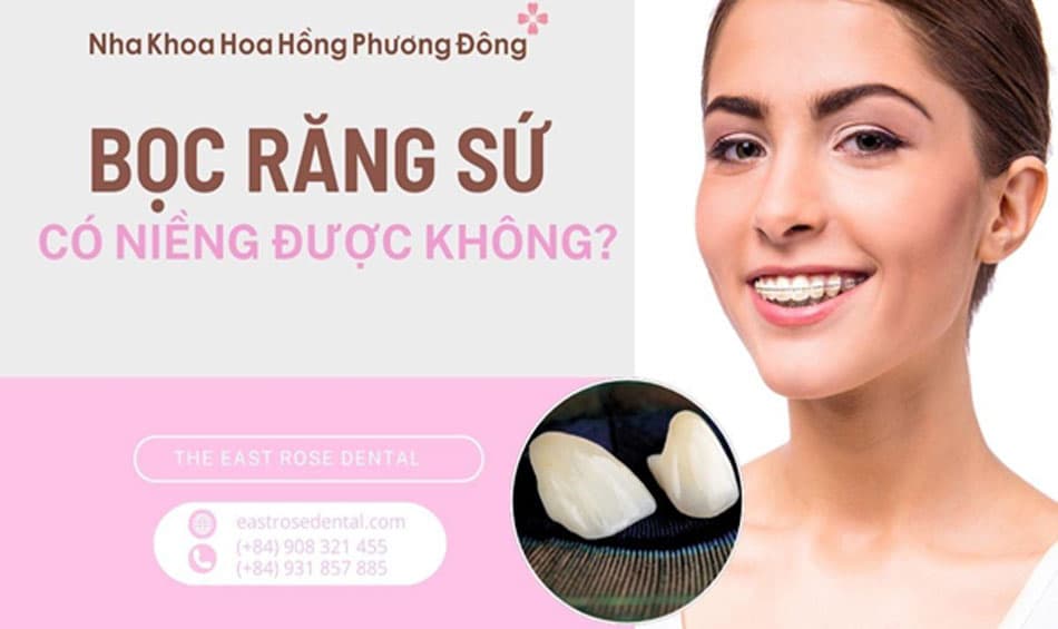 Giải đáp thắc mắc: Niềng răng sau khi bọc răng sứ liệu có khả thi?