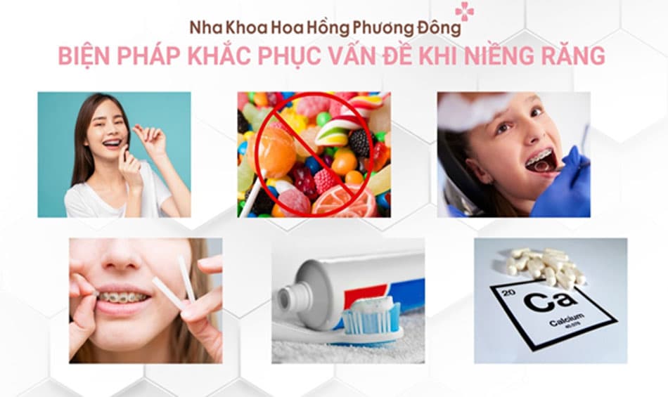 Cách khắc phục những vấn đề xảy ra khi niềng răng