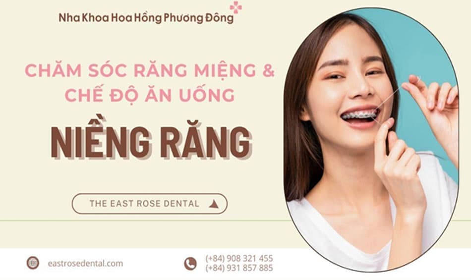 Cách chăm sóc răng miệng và chế độ ăn uống khi niềng răng