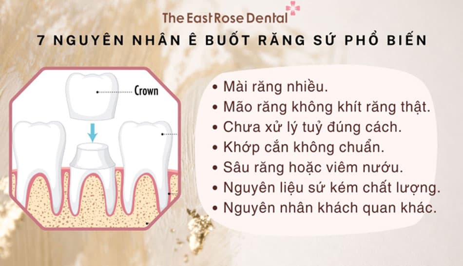 Các nguyên nhân phổ biến khiến răng sứ ê buốt