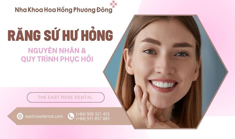 Nguyên nhân và quy trình tái tạo răng sứ bị mẻ, vỡ hoặc nứt