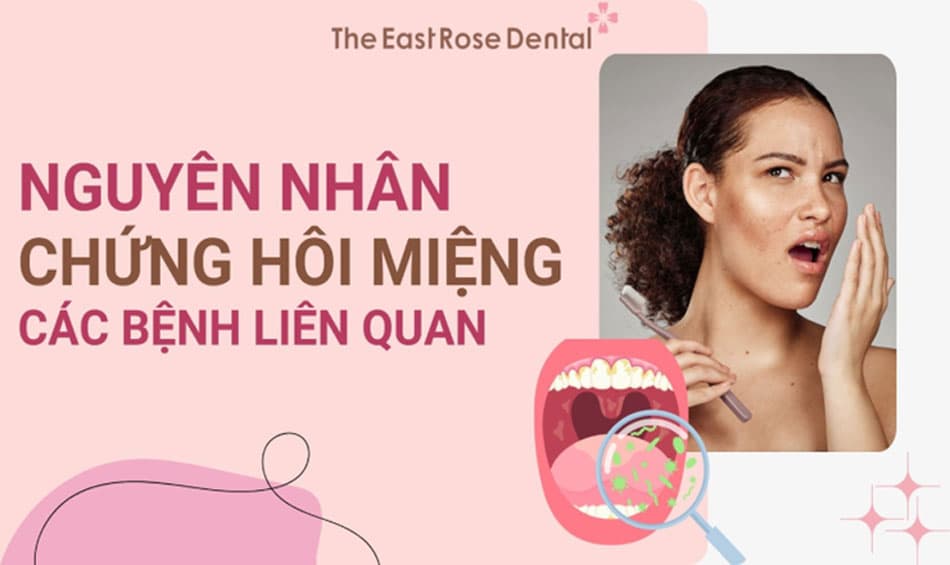 Chứng hôi miệng, nguyên nhân chính và các bệnh liên quan