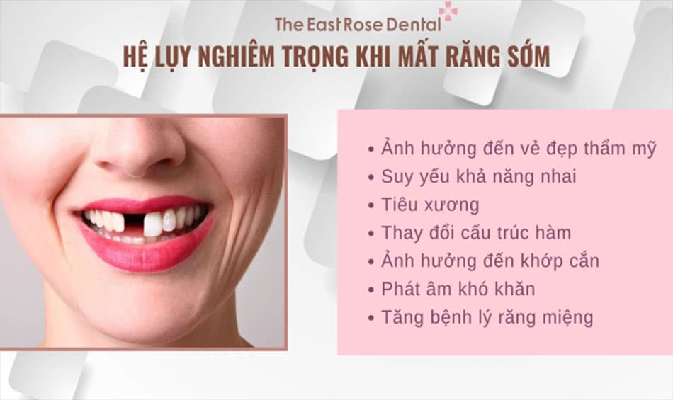 Mất răng sớm tiềm ẩn những vấn đề ảnh hưởng đến sức khoẻ