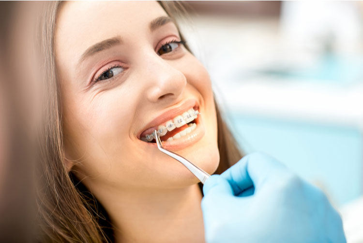 Lưu ý trước khi niềng răng