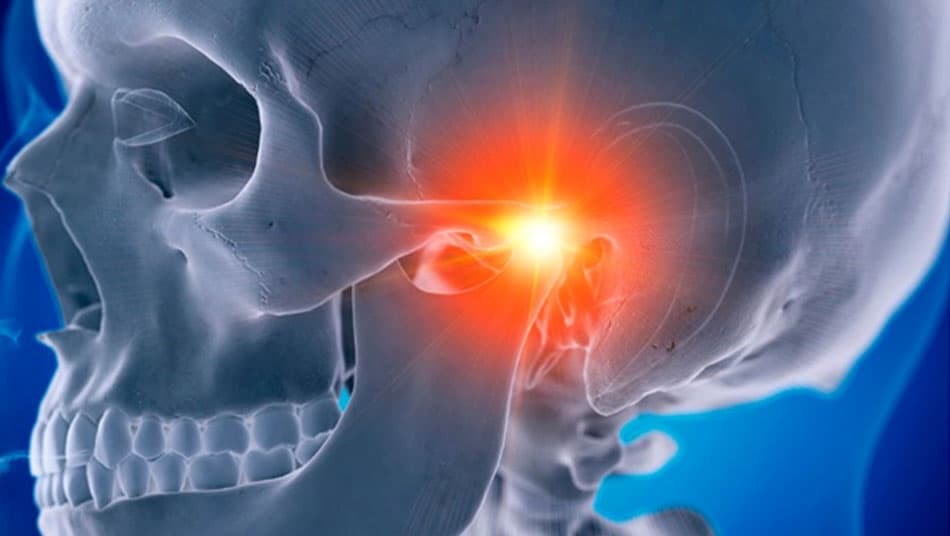 Bước sóng hồng ngoại giúp giảm cơn đau liên quan đến khớp thái dương hàm