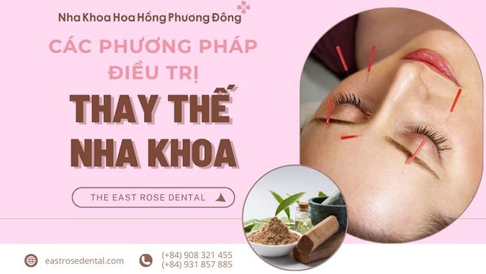 6 phương pháp thay thế nha khoa hiệu quả xung quanh bạn
