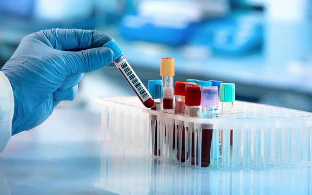 Why do you need a blood test before surgery implant?