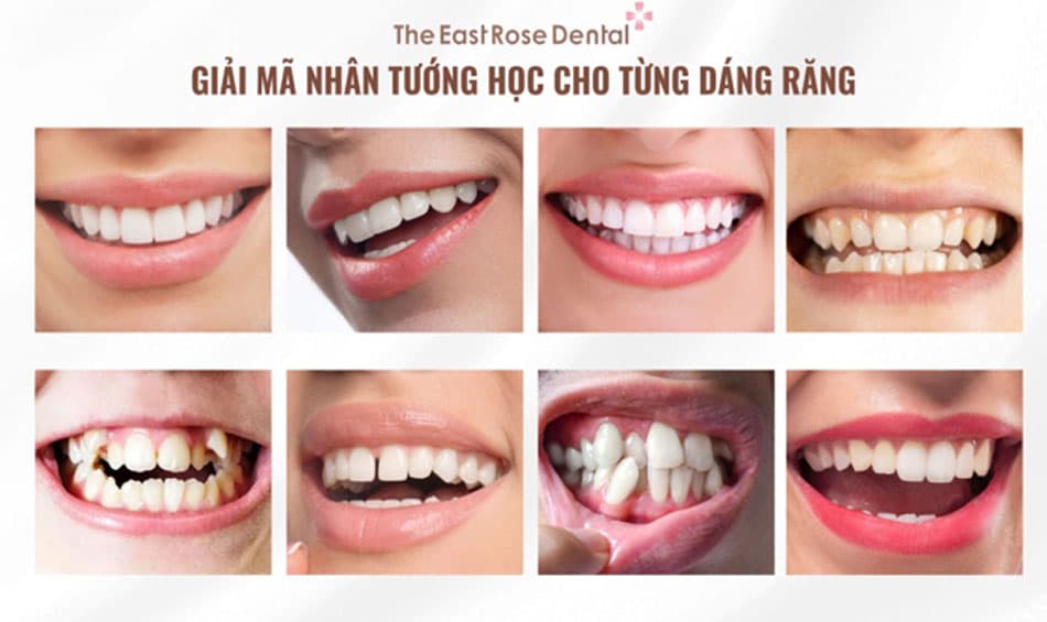 Giải mã nhân tướng học cho từng tướng răng