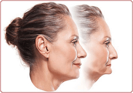 mất răng gây lão hóa sớm