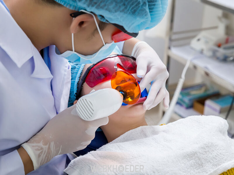 Procedures and methods of teeth whitening at the dentist and at home