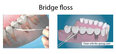 Bridge floss