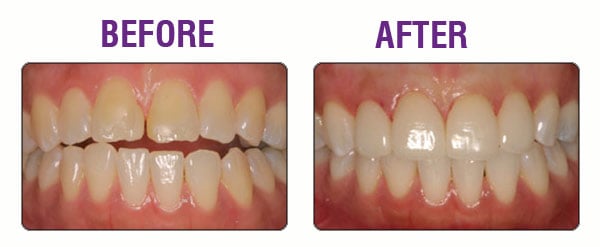 restore-your-smile-case-2