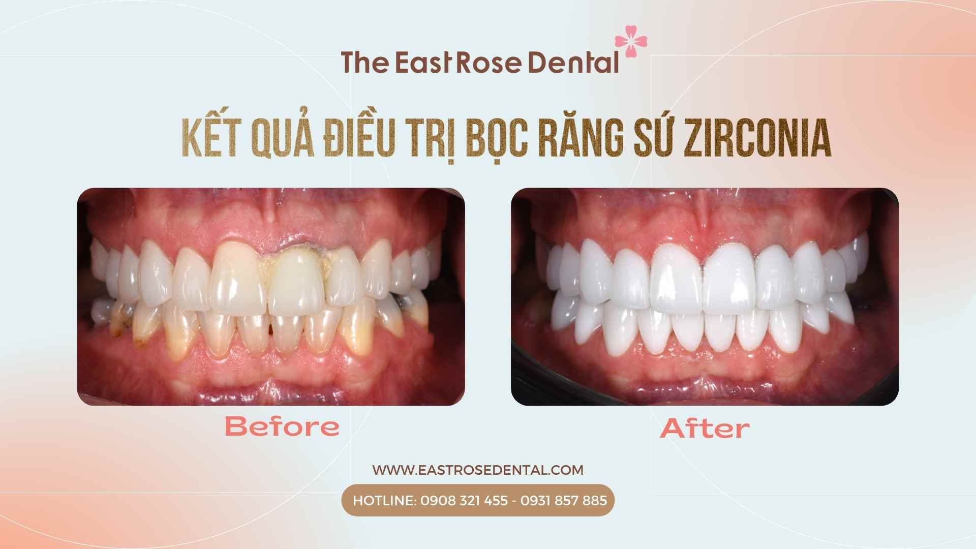 fff