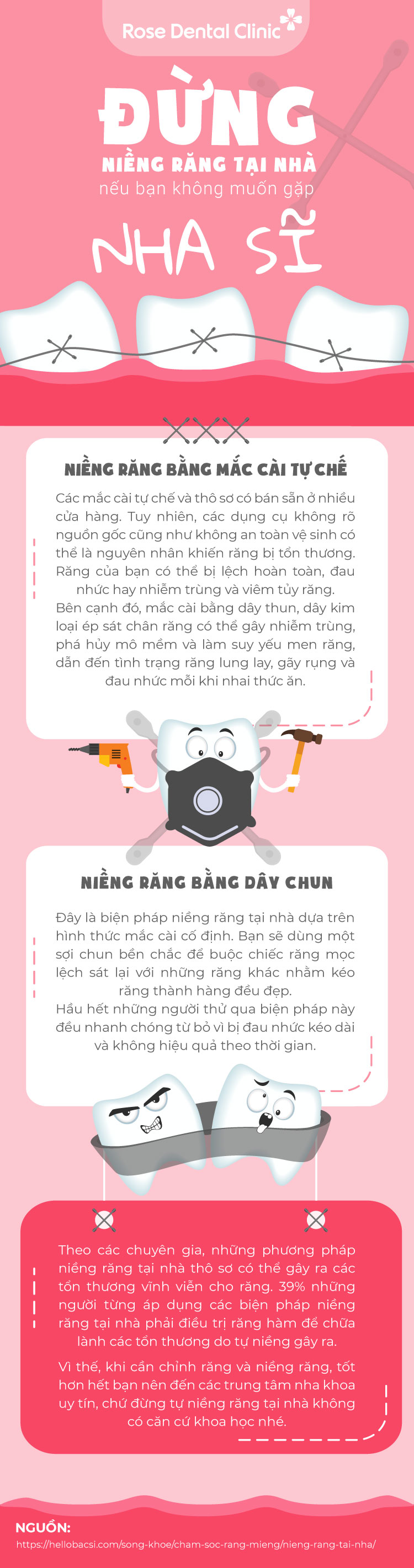 Niềng răng tại nhà
