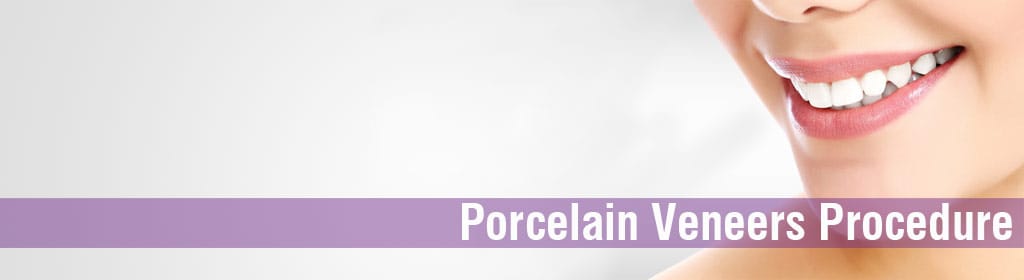 What is the procedure of dental veneers?