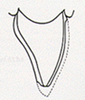 porcelain procedure