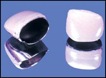 stainless steel crowns