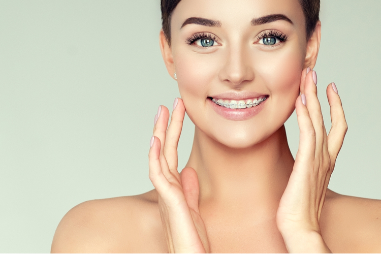 The process of getting braces: What to avoid after braces?