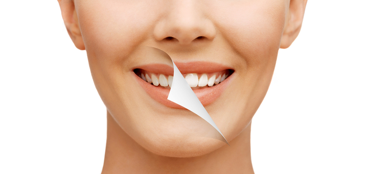 best place to get teeth whitening