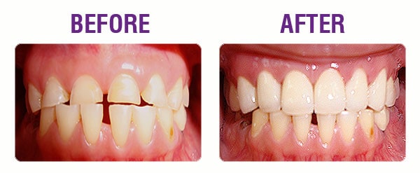 restore-your-smile-case-1