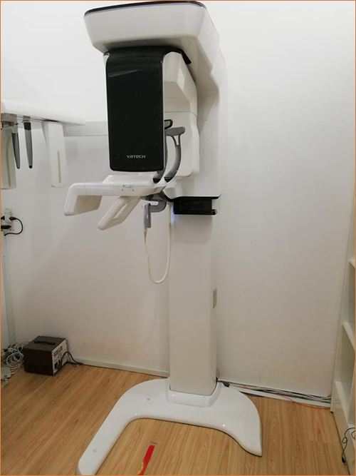 3D CT SCAN CONE BEAM X - RAY