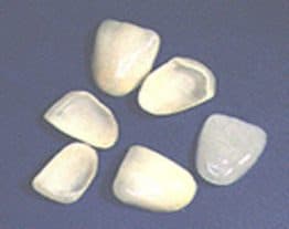 veneers