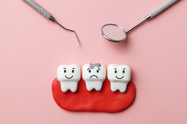 Broken tooth: What to do?