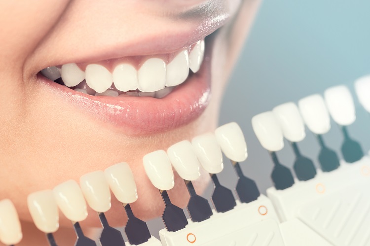 porcelain crowns fix buck teeth