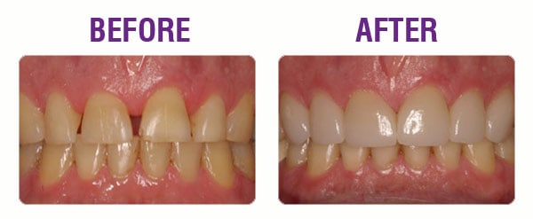 restore-your-smile-case-3