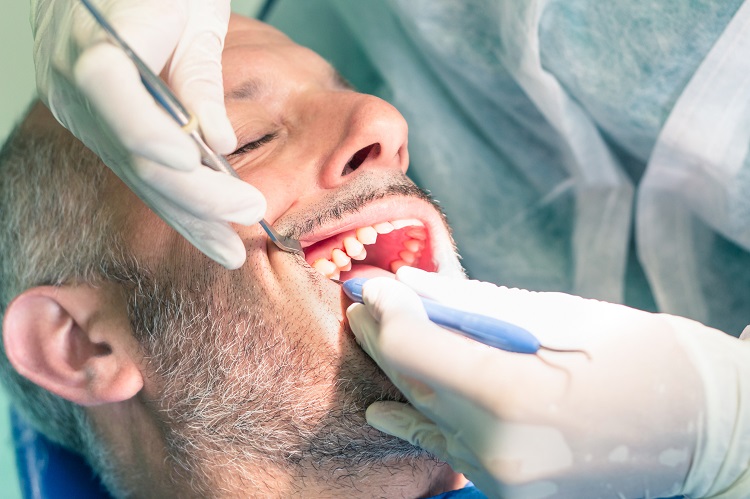 điều trị viêm chân răng có mủ